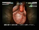 【THE 外科医】平成のブラックジャックと助手の術記【実況】Part22-2