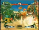 サコ弱すぎＷＷＷＷＷＷＷＷＷＷＷＷＷＷＷＷＷＷＷＷＷＷＷＷ