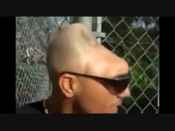 脳を失った男性