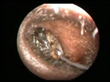 ごっそり耳掃除 Dr Vetri ニコニコ動画