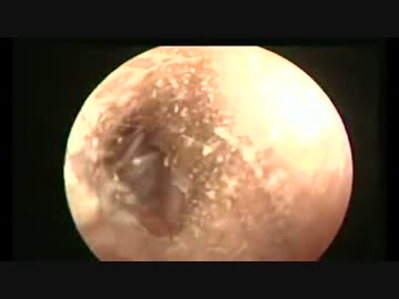 １分間耳掃除　【Dr.Vetri】