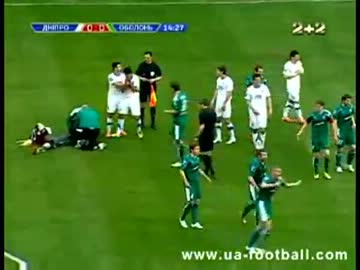 【閲覧注意】守護神の顔面がひどいことに