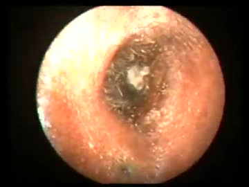 簡単耳掃除　【Dr.Vetri】