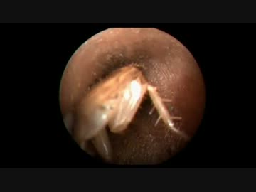 耳かき密室殺Ｇ事件