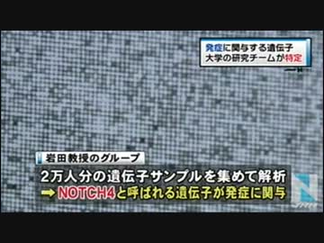 統合失調症、日本人発症に特定の遺伝子