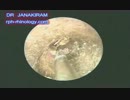 乾燥タイプの耳垢　【Dr.Janakiram】