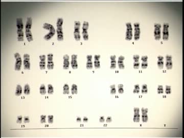 被曝治療83日間の記録 ～東海村臨界事故～(高画質版) (01 of 04)