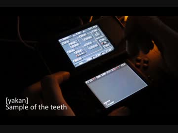 【DS-10 PLUS】 sample of the teeth 【夜間】 19回目