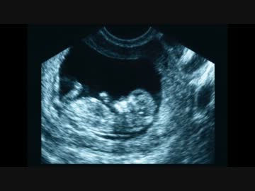 【NNI】 POPPY＋peakedyellow - mother 【オリジナル】