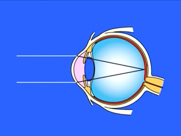 レーザーが変える加工技術　2/2