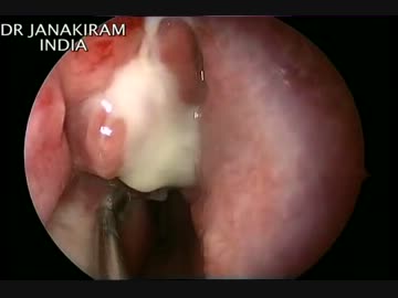 中学生に使われている性教育映像