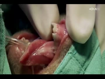 歯を引っこ抜かれた淫夢くん