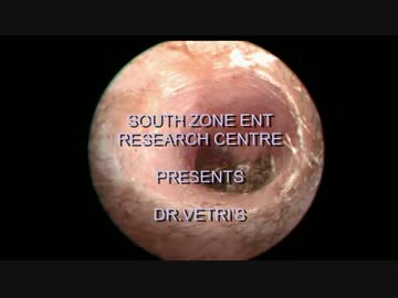 耳垢・・・じゃない