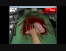 SurgeonSimulator2013　48秒でクリア