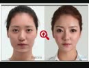 韓国の女性の整形ビフォーアフターがもはや原型を留めてないと話題