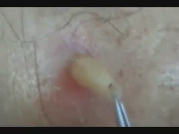 【グロ注意】たっぷりウマバエ【BGMなし】