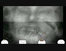 みんなで脱線実況動画：零～月蝕の仮面～　後編 パート6