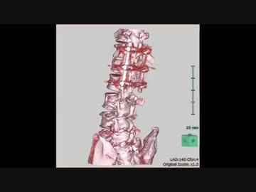 ところで俺の背骨を見てくれ、こいつをどう思う？