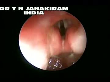 おまんこ壊れる