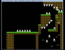 新作アイワナプレイ記 part380