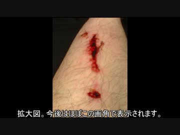 ラップとワセリンで怪我の治療をしてみる。