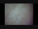 【ニキビ】　全ファイル中最強クラス