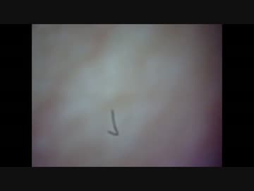 【ニキビ】　全ファイル中最強クラス