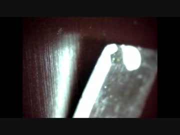 膿んだニキビから芯が出る貴重映像