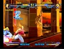 ポート24八事　北斗の拳　ひげ（TH）対アルミ（SH）Part.2