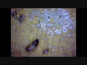 不法侵入者に漆黒の鉄槌（毛根）を