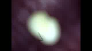 日本初？くさい玉を顕微鏡500倍で観察