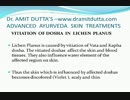 Lichen Planus Ayurvedic Treatments : Treatments in Lichen Planus Ayurvedic  - Dr. Amit Dutta
