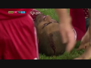 【BPL】Liverpool v Stoke【MotD】