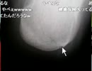 20150212-1 NER=ネル プロレス配信で骨折して松葉杖になりました。 1