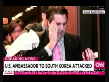 在韓米国大使襲われ顔と手を負傷！犯人は日本大使にも瓦礫を投げたキム