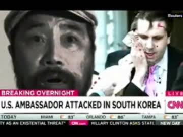 駐韓大使は80針縫う大怪我に頭のおかしい男か？と流石のCNNも…w