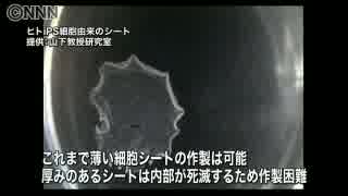 ｉＰＳで“立体的な臓器つくる技術”発表会