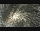薄毛を改善！！これだけ聞けば絶対にハゲは治ります！！！その４