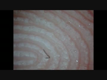 汗腺から汗が出る瞬間