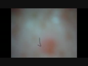 鼻の角栓とるよーーーーー