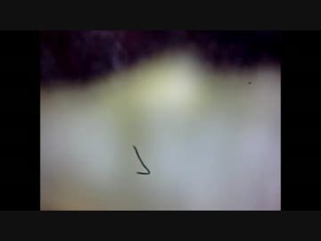 黄金の角栓