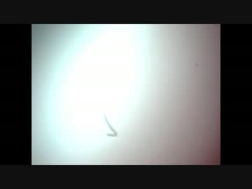 新ニキビのフルコース（絞り出し～観察）