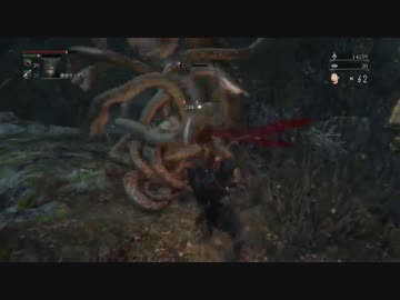 【残機６２】Bloodborne（ブラッドボーン）初見実況 part.48