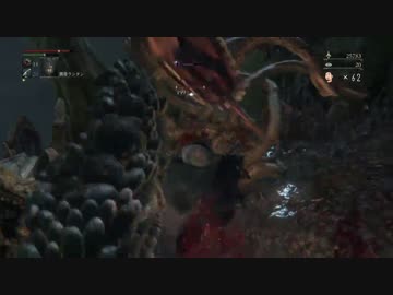 【残機６２】Bloodborne（ブラッドボーン）初見実況 part.49