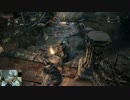 【リアル片手縛り】Bloodborne -part14-【初見実況プレイ】