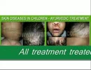 skin treatment by dr amit dutta
