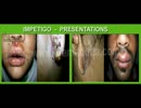 Ayurvedic Skin Treatments : Ayurvedic Skin Specialist - Dr. Amit Dutta