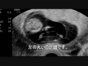 赤ちゃん作ってみた（10週）