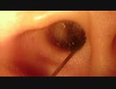 ear picking. deep inside.