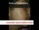 AYUR-SUDHA : bodysolutions-sd_cosmeticskinproblems